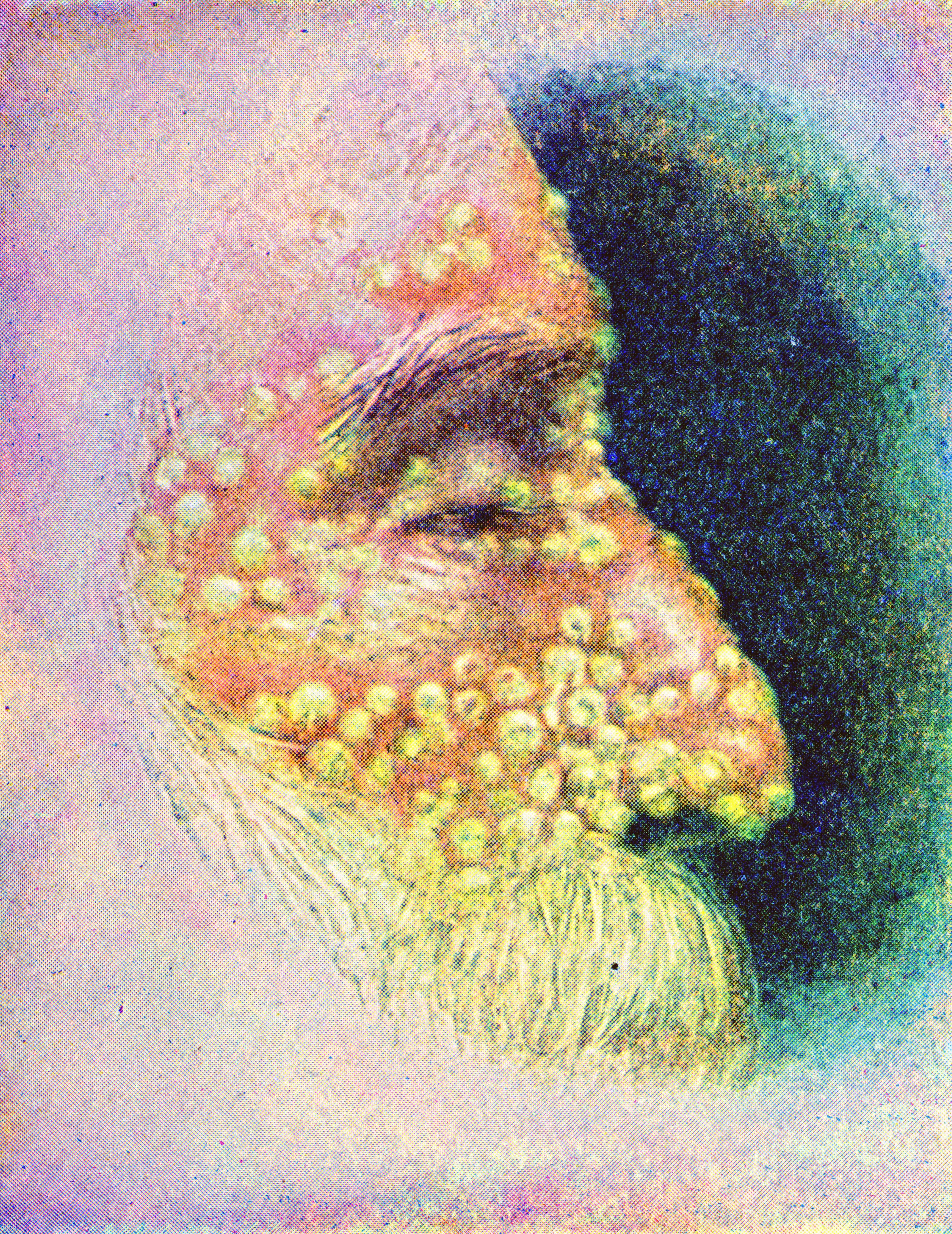 Profile of a man with smallpox